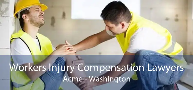 Workers Injury Compensation Lawyers Acme - Washington